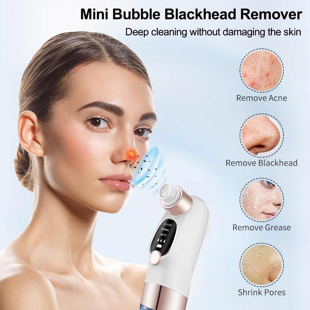 Siyah nokta Remover Elektrikli - Air Bubble Remover incelemesi ve fiyatı